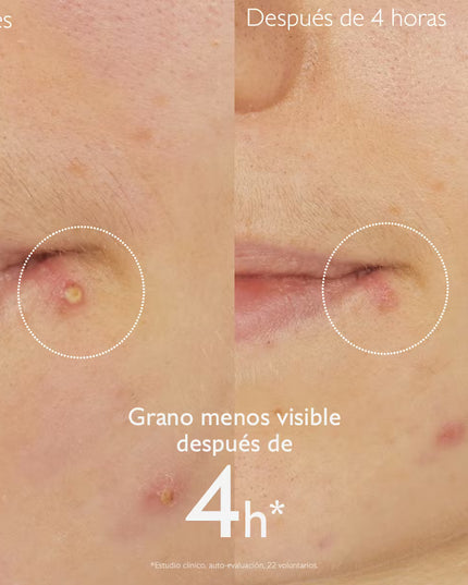 VINOPURE STOP GRANOS