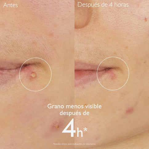 VINOPURE STOP GRANOS